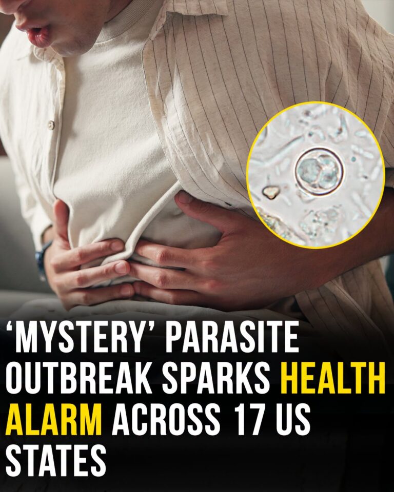 ‘Mystery’ parasite outbreak sparks health alarm across 17 US states